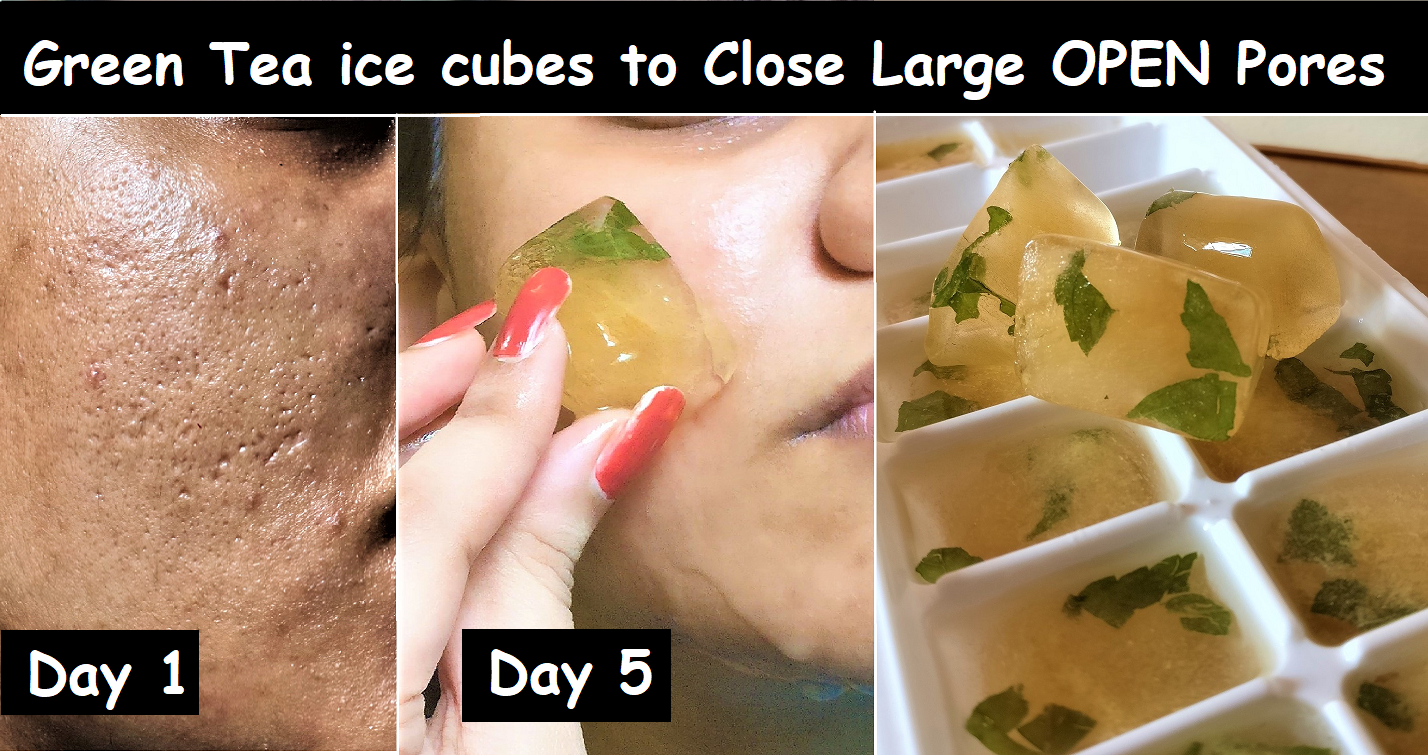 green-tea-ice-cubes-for-dark-spots-pimples-large-open-pores