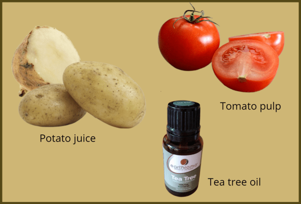 potato face pack for acne