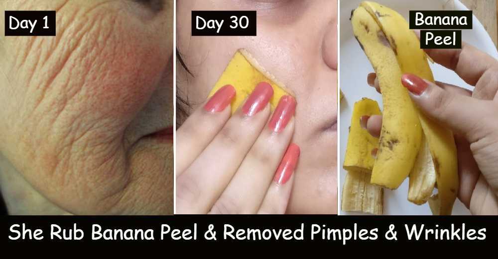 Rub Banana peel on Face for Clear Skin Remove Pimples & Dark Spots