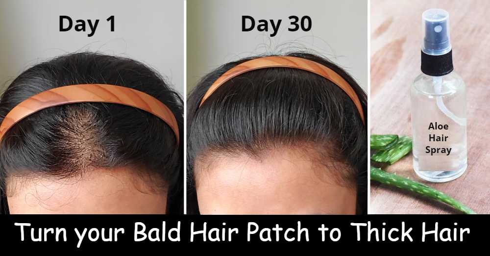 5 Best Homemade Hair spray for Hair Growth